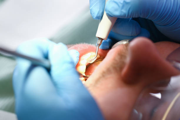 Best Emergency Dental Care for Trauma or Injury in Wickerham Manor Fisher, PA