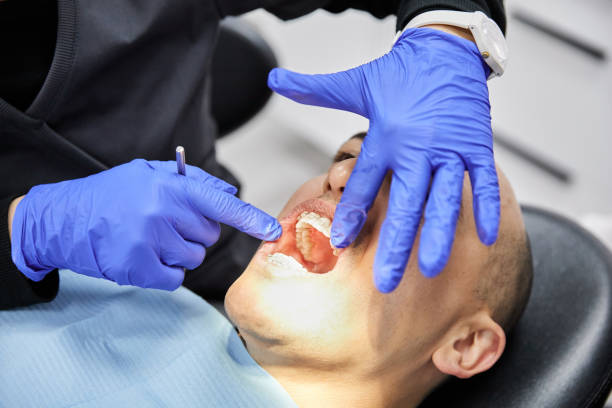 Best Emergency Broken Tooth Repair in Wickerham Manor Fisher, PA