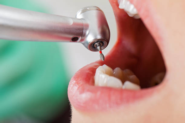 Best Walk-In Emergency Dentist in Wickerham Manor Fisher, PA